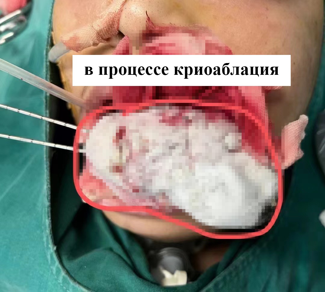 fuda07_712935.jpg