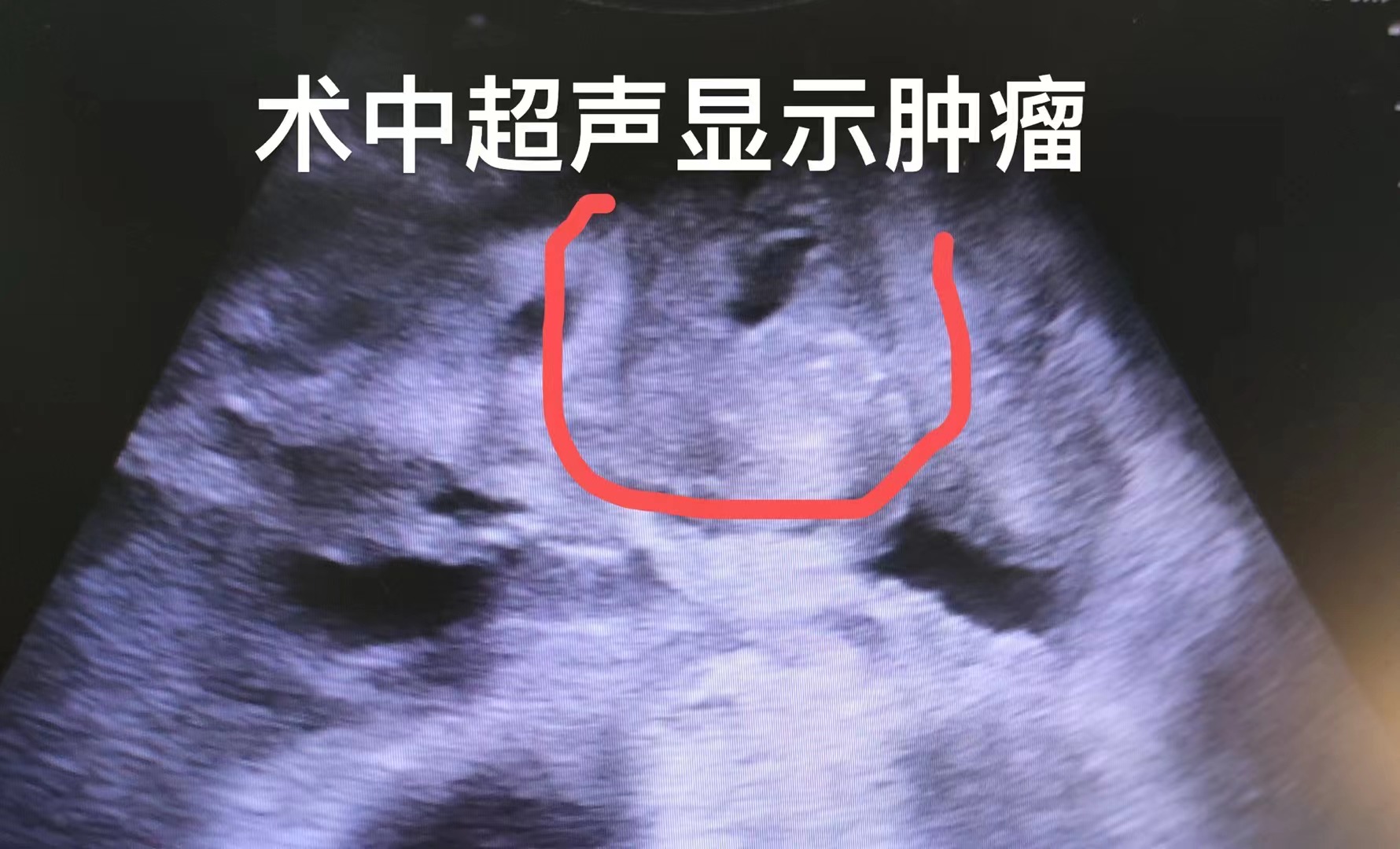 fuda22_189108.jpg e0eb09d218982b2be32d3630b2cc907.jpg