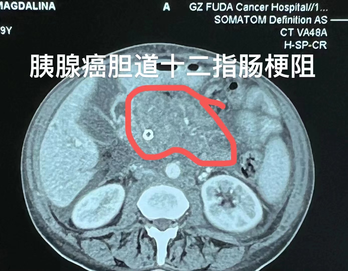 fuda22_238143.jpg fuda22_238143.jpg
