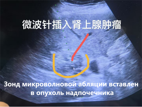 fuda20_592846.png fuda20_592846.png