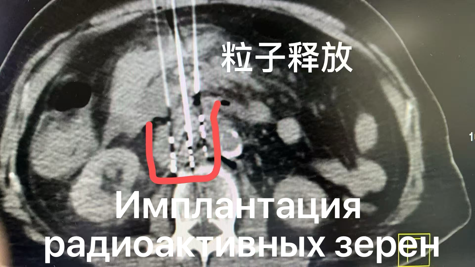 fuda08_385449.jpg 20251f8dcd6f60b0c0d7d5f835fbc1a.jpg