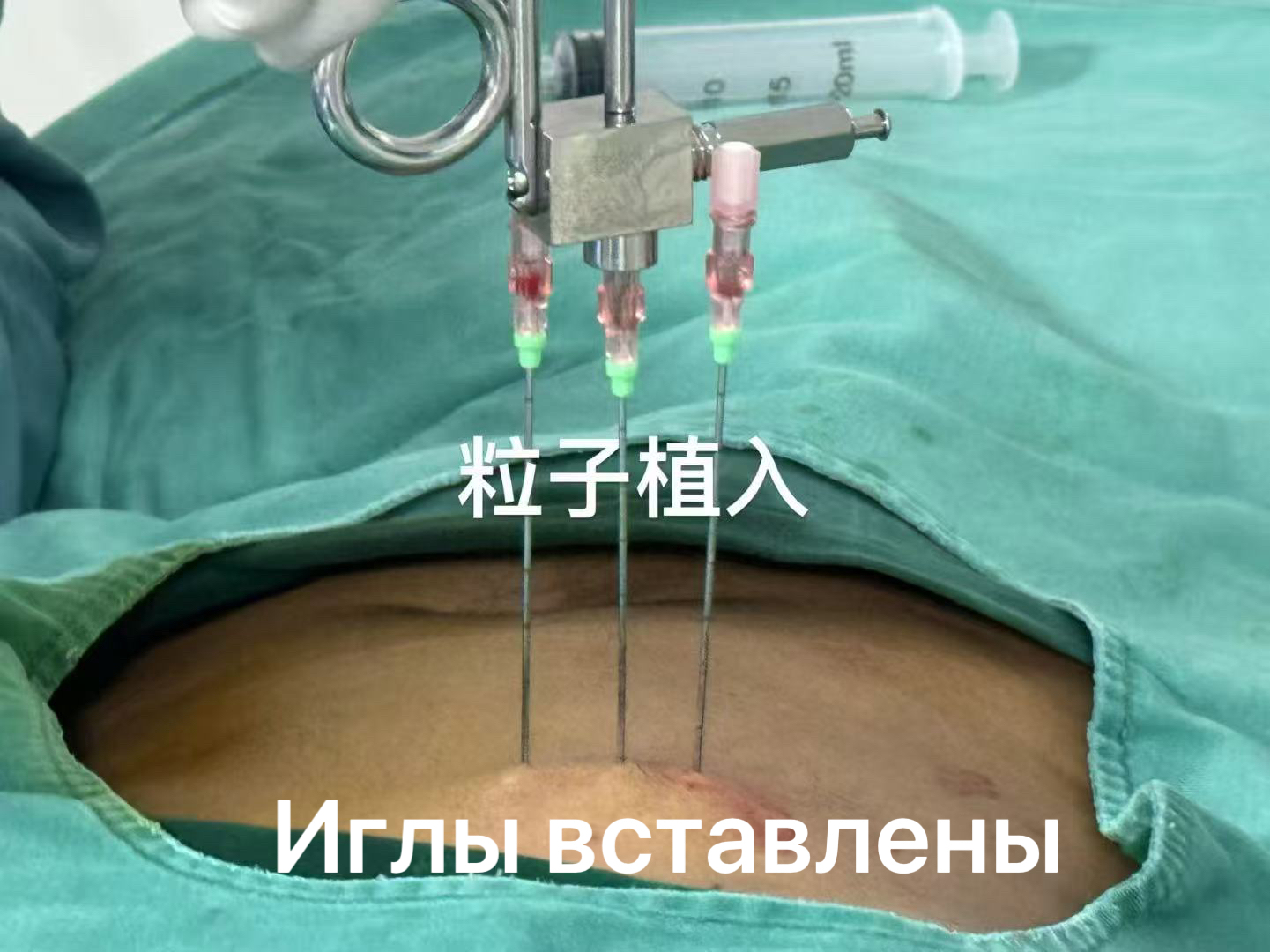 fuda08_858411.jpg cfb4c9bba25b051a85dbd4dca5ad688.jpg