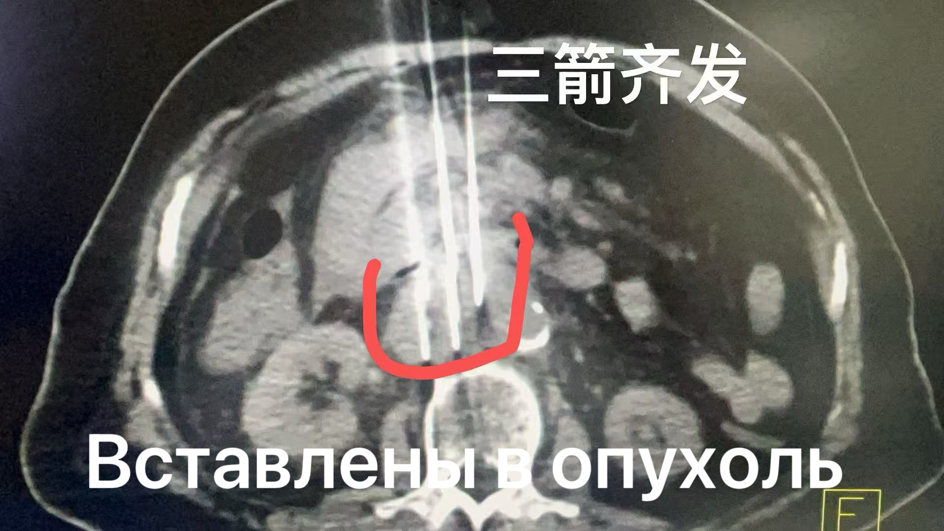 fuda08_957549.jpg acee8be340156c543d2c51ca9a88bb6.jpg